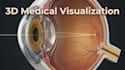 create ai 3d medical animation, anatomy explainer surgical video