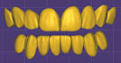 create professional 3d dental cad designs using exocad