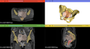segment medical data and create accurate medical 3d models