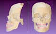 do dental cbct dicom segmentation and stl conversion
