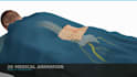 create 3d medical device animation, surgical procedure visualization