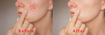 remove background and use image retouching