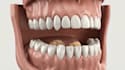 create 3d dental animation for implants, teeth and oral surgery 3d video