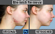 do professional skin retouching and severe texture removal