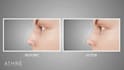 create realistic 3d medical animation, surgical procedure, anatomy visualization