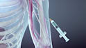 create 3d medical immunotherapy cancer molecular moa animation biotech explainer