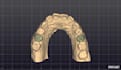create professional dental cad designs in exocad