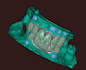 do professional dental cad cam design using exocad