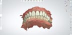 design anatomical crown and bridges using 3shape dental system