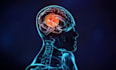 create 3d medical animation, surgical and anatomy explainer videos