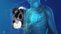 create 3d cardiovascular medical device animation, stent and catheter explainer