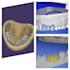provide expert exocad dental cad design services