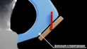 3d wow medical animation