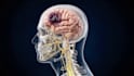 create 3d medical surgery animation brain anatomy neurological disease explainer