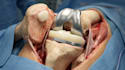 create 3d medical animation for surgical procedure or anatomy