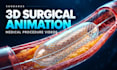 create surgical animation and medical procedure videos