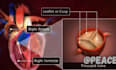 create 3d medical animation and anatomy explainer videos