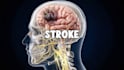 create 3d medical animation, orthopedic animation and surgery animation