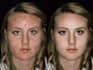 do model photo editing and retouching