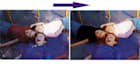 old photo restoration repair fix damage