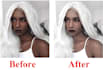 remove dark spots on face, damage, pox scars etc
