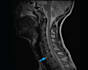 a second opinion on any radiology scan mri, xray, ct, US