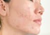 write an engaging skincare and lifestyle article for your brand
