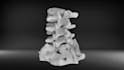 create medical 3d model from dicom, ct or mri images