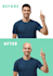 make hair on the bald head