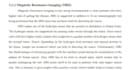 research and write a summary of a topic
