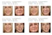 develop a face recognition app