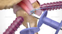 create medical 3d animation video