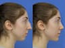 create a realistic cosmetic edit preview using photoshop