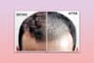 create before and after images for your cosmetology, medicine, helth,  business