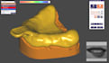 design individual trays from 3d stl files