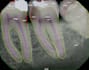 do dental image annotations accurately as a dentist for your ai
