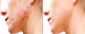 do high end beauty retouch
