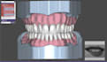 design dentures and overdentures