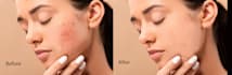 remove acne, blemishes, and repair old image efficiently