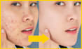 do high end skin retouching, photoshop retouch, wedding photo retouching