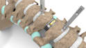 do 3d medical animation for a product or procedure