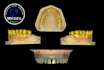 design dental design with exocad software for you