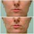face retouching and background removal reducing the novice