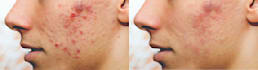 do skin retouching and keep it natural