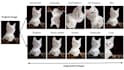 do data augmentation on images
