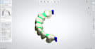 design dental crowns,bridges,veneers in 3shape