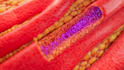 create medical animation video