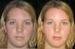make you a skin retouch