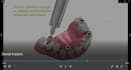 make dental 4d animated videos