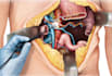 create surgical and anatomical art for medical professionals